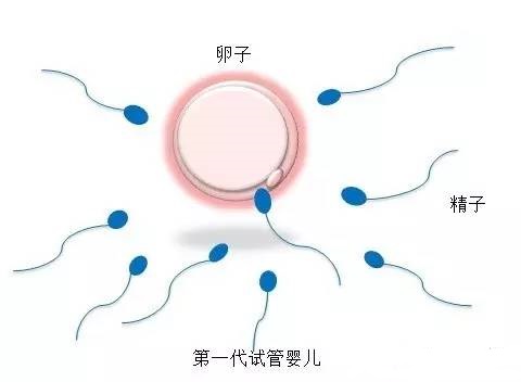 反复流产